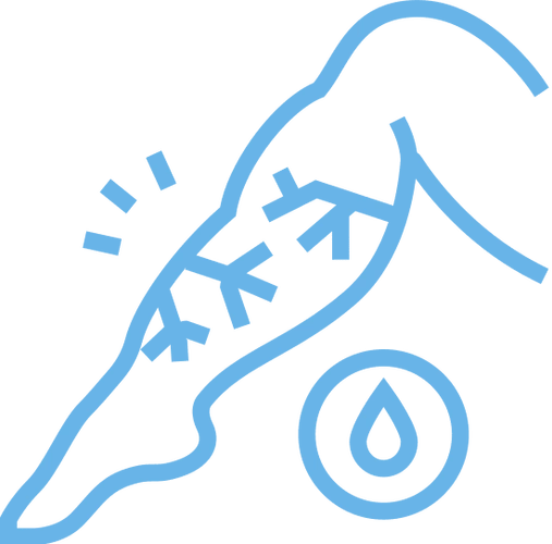 venous edema line icon vector illustration