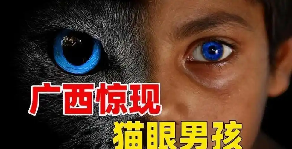 回顾一男童天生拥有蓝眼夜晚看东西如白天检查结果让全家沉默