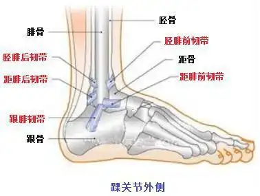 踝关节扭伤别大意,小心外侧副韧带损伤|骨折|腓骨_网易订阅