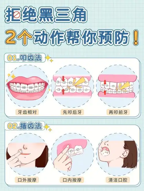 2个动作 每天10分钟,远离黑三角/牙龈萎缩97