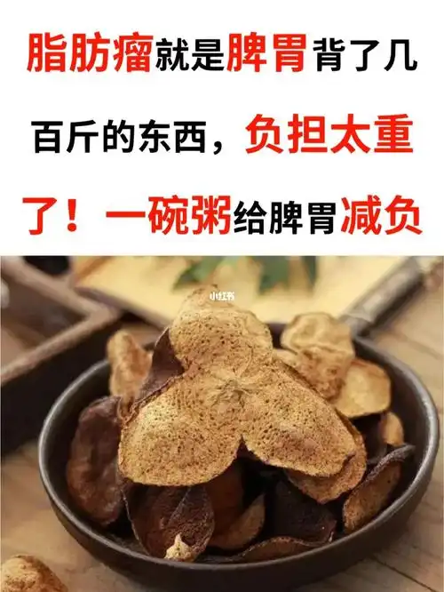 对待脂肪瘤要给脾胃减负73