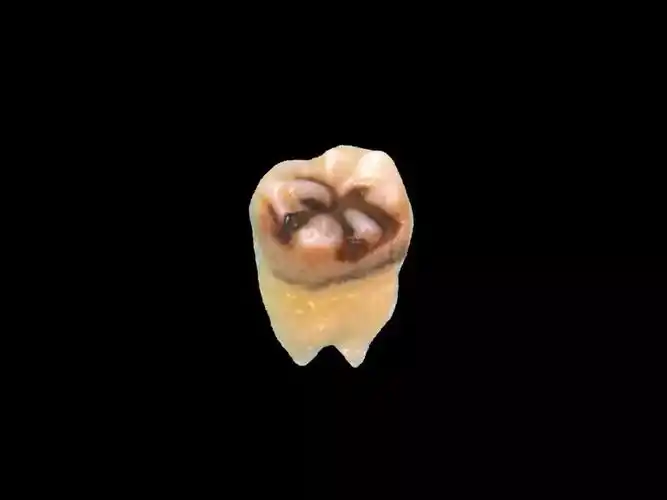 健康洗牙是一种什么样的体验