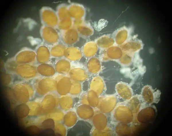 蜻蜓的卵和幼虫是什么样子的