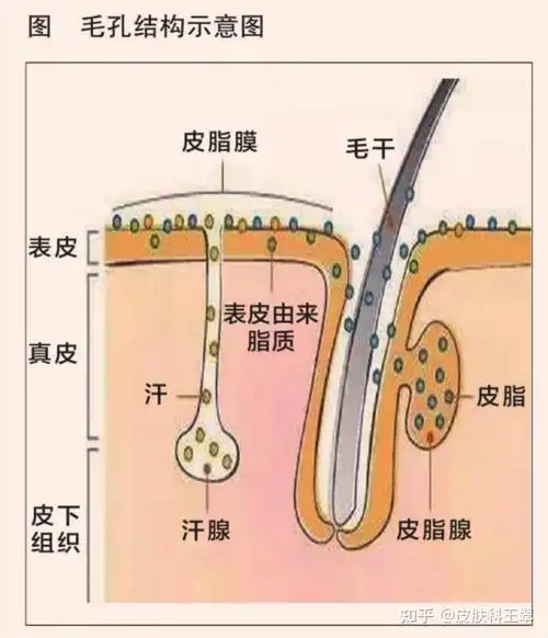 开口,肉眼可见的毛囊皮脂腺开口,肉眼可见内含角栓的毛囊皮脂腺开口