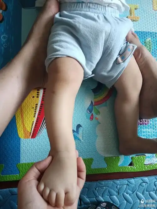 各位宝妈,你们家小宝宝这样吗?小腿有点弯.怎么办?