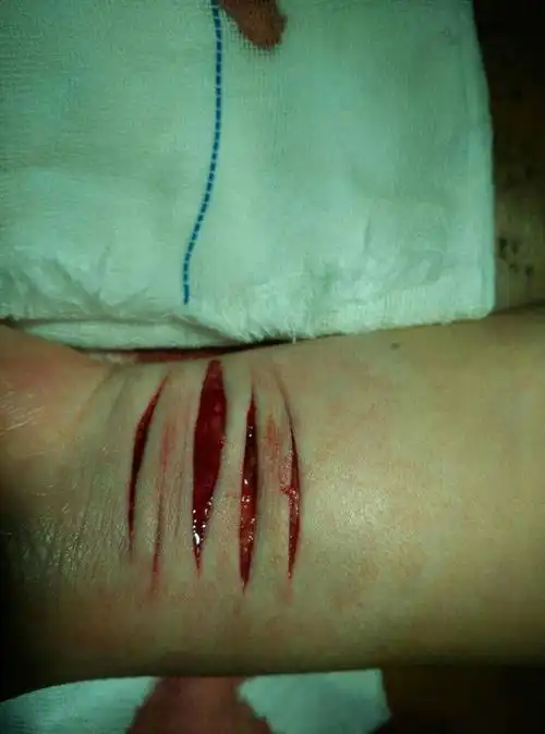 割腕照片