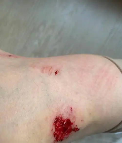 39岁张静初晒骑行照运动少女感十足,摔伤后淡定自拍心脏很强大_网易