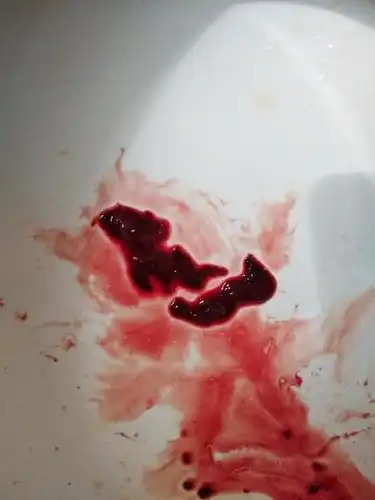 大姨妈来了,然后掉两块像肉一样的东西,是什么?