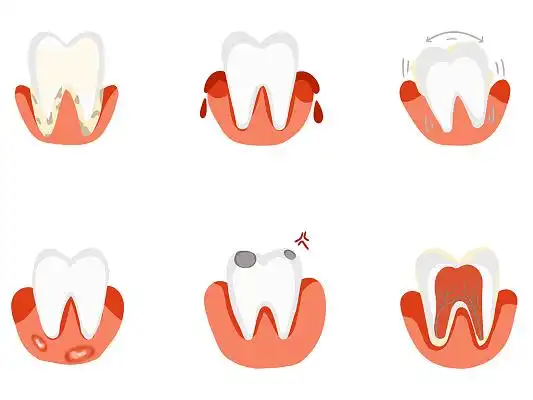卡通扁平口腔结构图牙齿疼痛