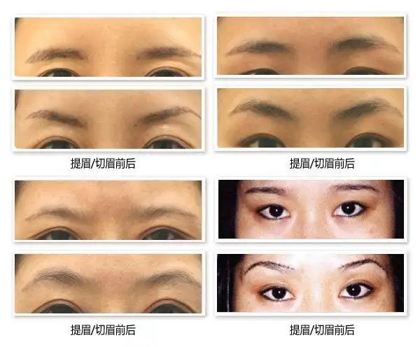 喵总科普:如果还不清楚切眉和提眉的区别请看过来
