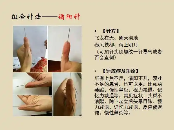 阴阳九针组合针法之——循阳针