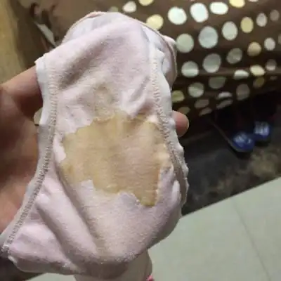 今天孕12周,半夜忽然感觉内裤湿湿的,去厕所一看内裤上有一小片黄色的