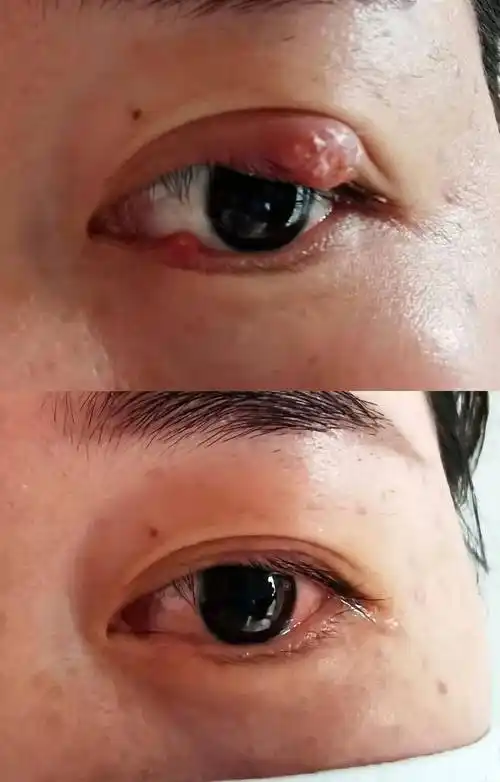 吓到了偷针眼险些偷了她的容