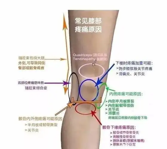 2个护膝保养动作,稳固脆弱膝关节,运动走路不腿疼!