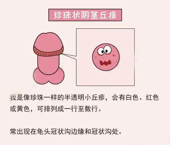 的丁丁上都有可能长一些「小疙瘩」,「小肉丁」,「小痘痘」等新生物