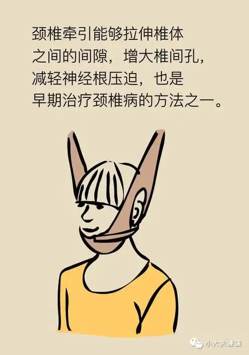 颈椎病不知道这些,就别乱治疗!