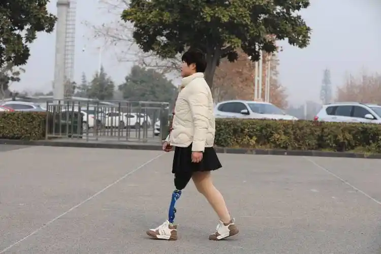 安装大腿假肢对残肢条件有哪些要求?_装配_长度_皮肤