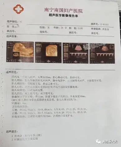 3次胎停后做了这个手术,再次怀孕._诊治_生殖_林医生