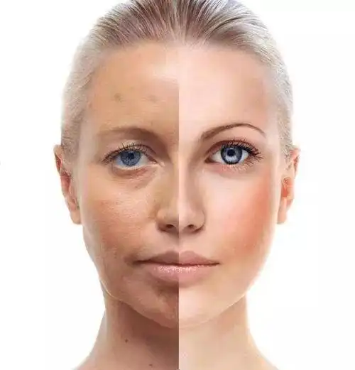 黑黄皮肤要怎么变白?日常养好这几个习惯就好