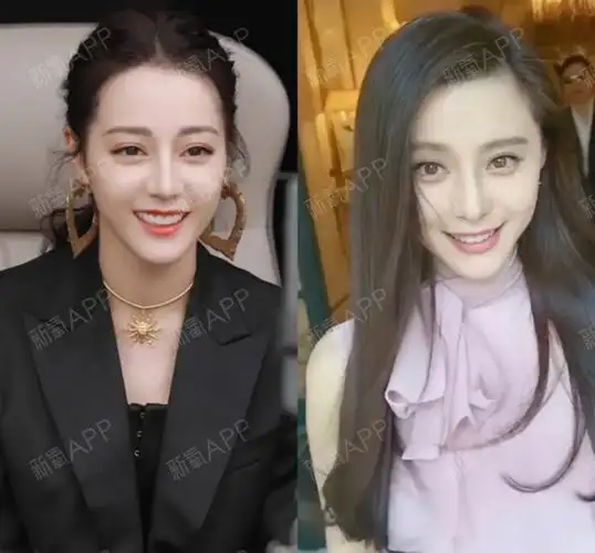 平行双眼皮到底更适合谁呢[:144]?代表女星:迪_圈子-新氧美容整形