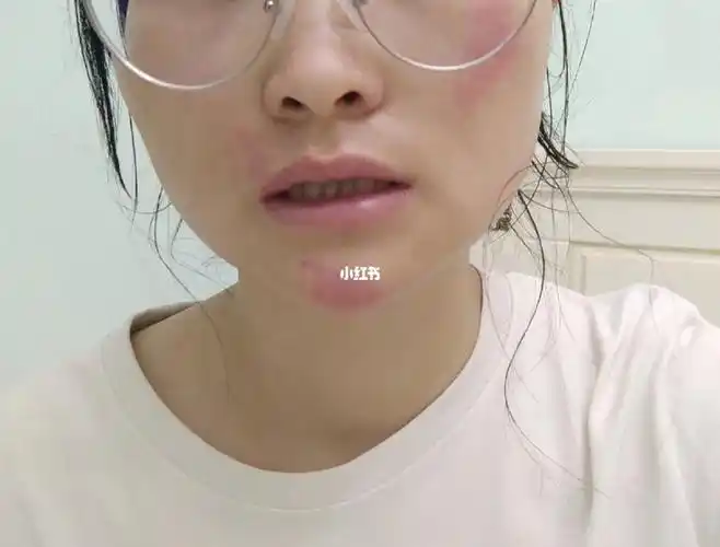 摔了一跤脸着地