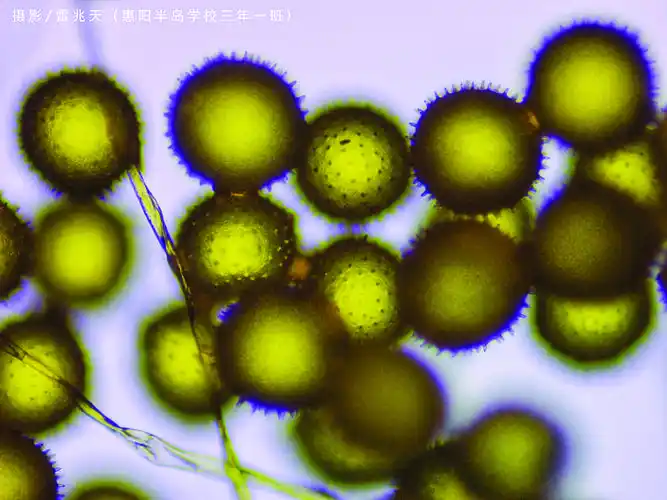 显微镜下的花粉颗粒