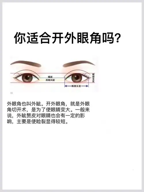 你适合开外眼角吗