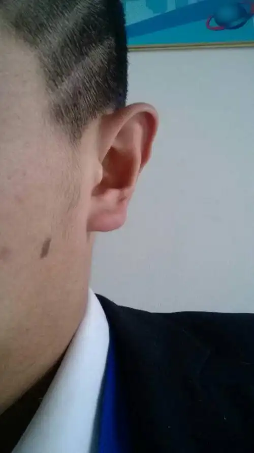 哪位相面高人看看这是耳有垂珠吗?顺便看看那黑记.