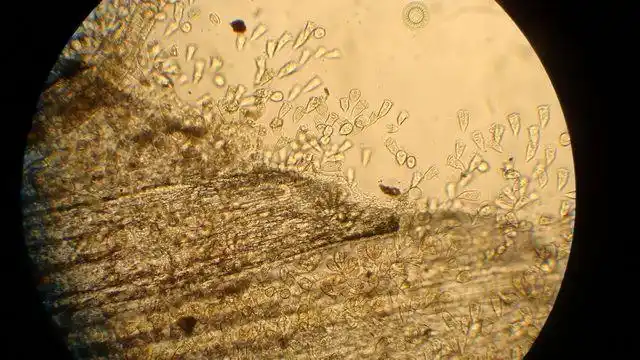 有纤毛虫寄生于鱼苗鳃部和皮肤引起鱼苗白头,白嘴症