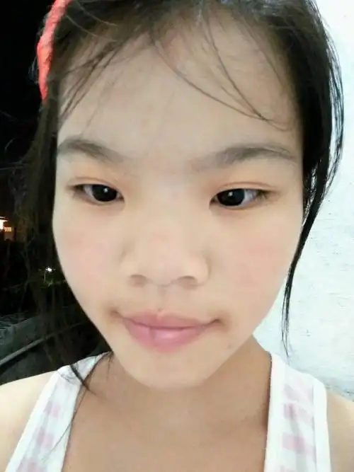 我的鼻子是不是太塌了,从小就这样,要不要去整一下?