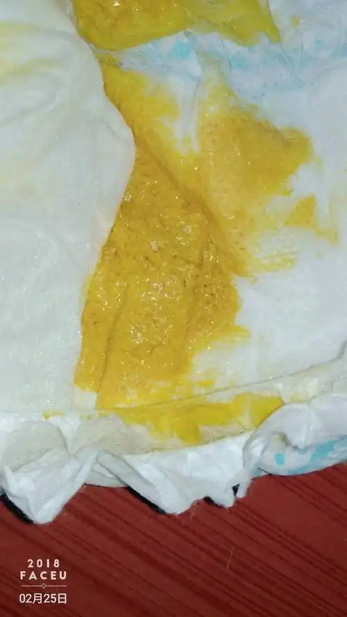 八个月宝宝拉的粑粑这样怎么回事
