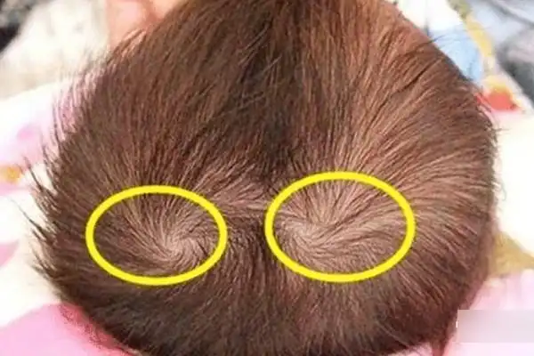 女孩头上两个旋好不好?