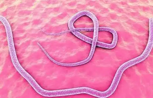 怎么预防钩虫病?_问答大全_美文阅读网