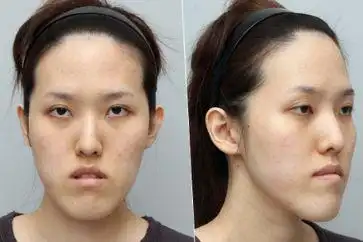 地包天人的性格命运解析