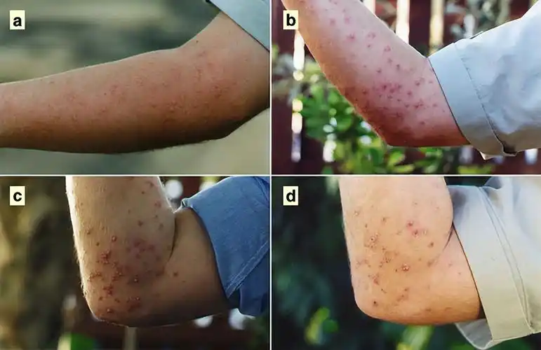 家白蚂蚁图片(比上海的白蚁更可怕) - 赤虎壹号