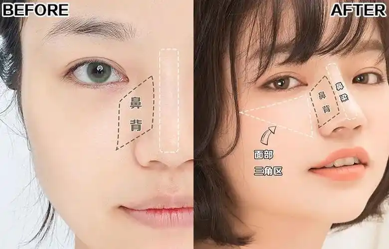 徒手捏鼻术|鼻背宽,山根低这样修容,会好看10倍!