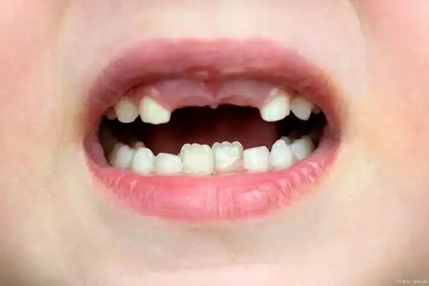 首先,我们需要了解乳牙和恒牙的差异.