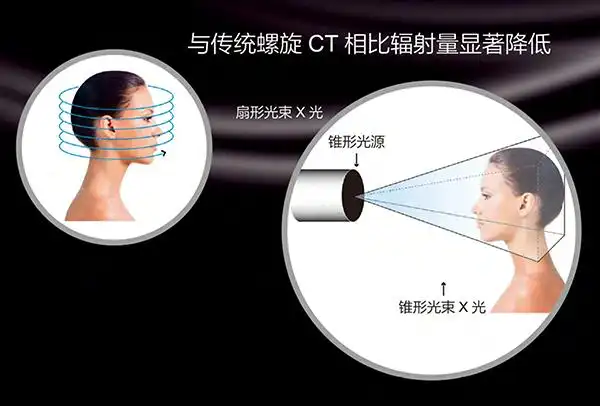 意大利newtom vgi口腔扫描技术