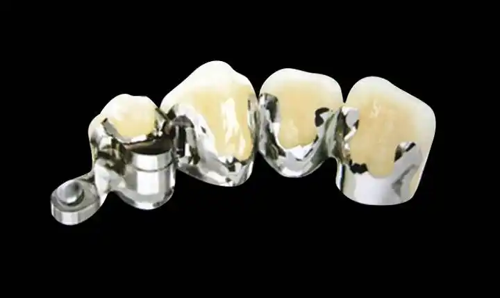 德国bego生物钴铬烤瓷