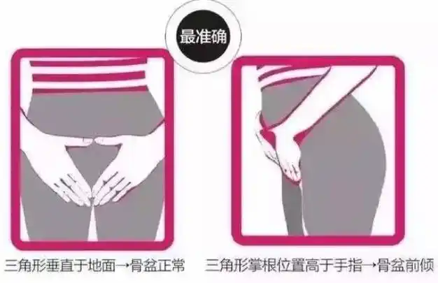 2,小腹下面三角区肥大能减吗