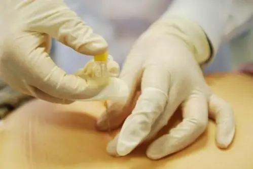 中医针灸,埋线减肥,守卫健康.