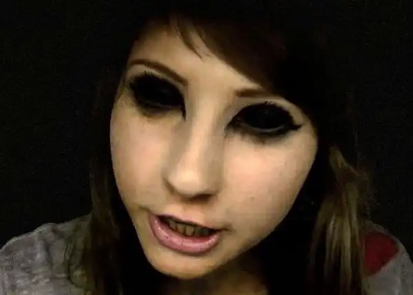 英国斯塔福德郡发现神秘黑眼小孩眼睛全黑无眼珠眼白