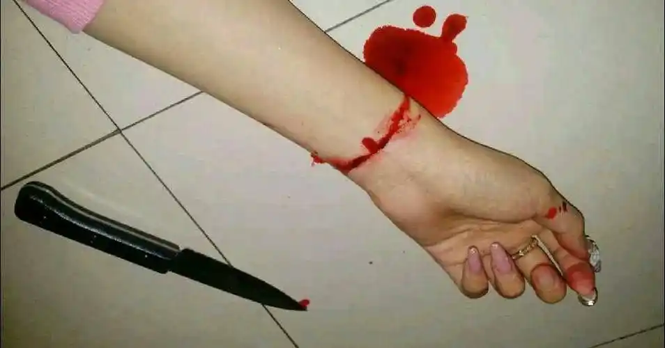 我的手臂 手腕上有很多自残的疤痕 很明显,不过是三四女生自残割手腕