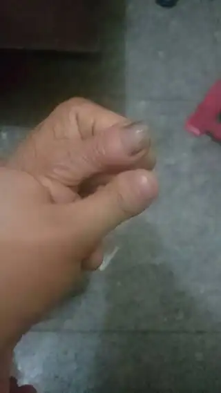 我的大拇指又短又粗又扁,整个形状呈蛇头状,有什么古老说法吗?