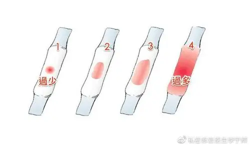 例假量少时间短出了什么问题