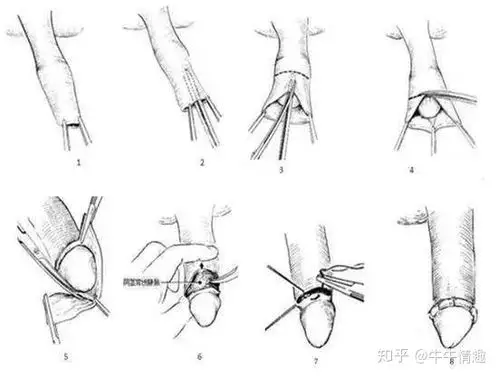 血腥的沙漠之花—非洲女性割礼