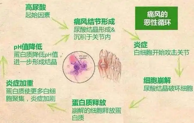 【案例】葆婴usana产品成功调理痛风病症