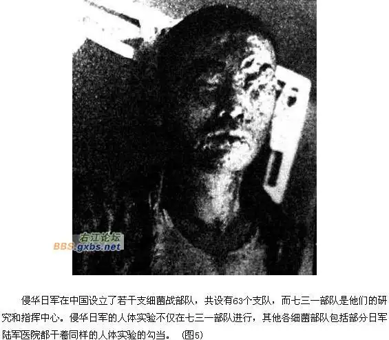 【历史上的今天】日军731部队对中国军民投入细菌武器