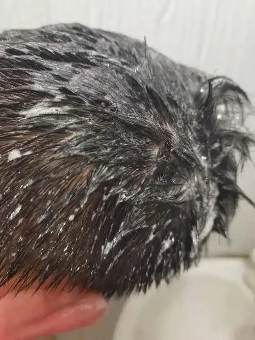 大块大块地掉头皮屑有什么好用的男士去屑洗发水推荐