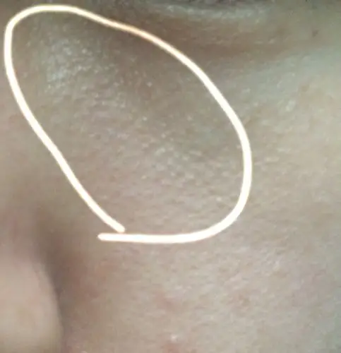 各位网友你们好,本人女,27岁,请问脸上的这个凸起的小颗粒是什么?